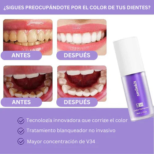 SOLO POR TIEMPO LIMITADO! Blanqueador Dental
